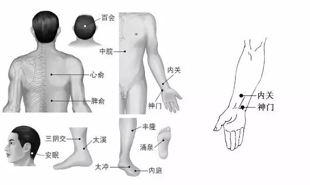 深圳丝袜按摩会所穴位按摩治疗失眠多梦