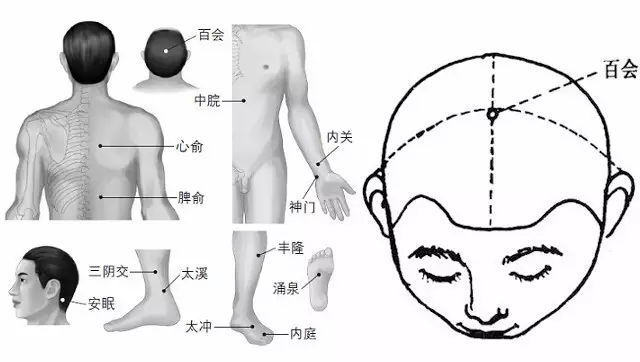 深圳丝袜按摩会所穴位按摩治疗失眠多梦