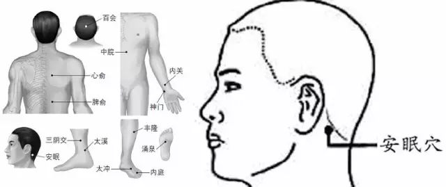 深圳丝袜按摩会所穴位按摩治疗失眠多梦